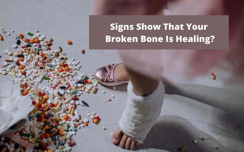 What Signs Show That Your Broken Bone Is Healing?