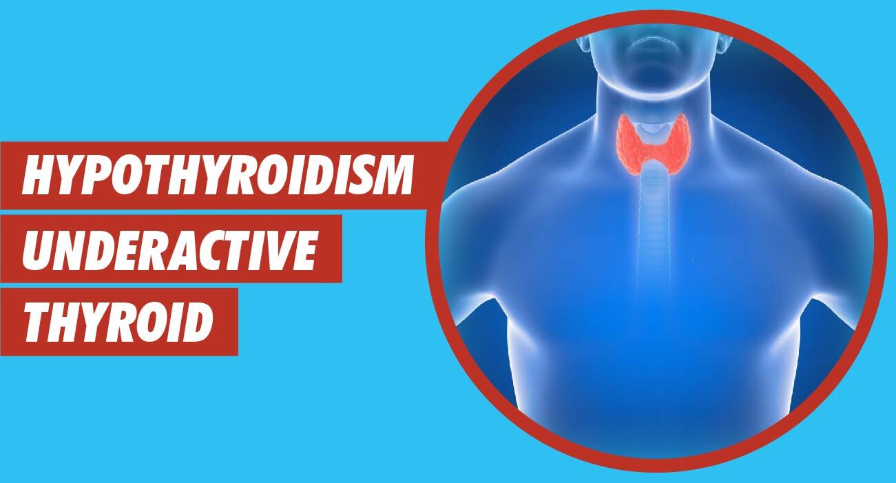 Hypothyroidism - Underactive thyroid